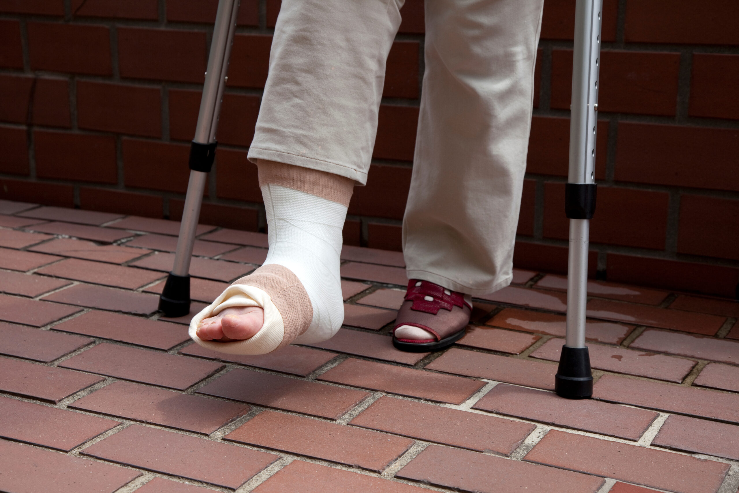 Personal Injury Representation